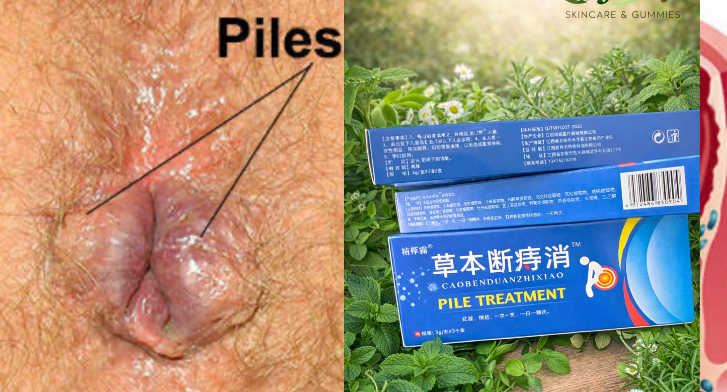 🌿 PILE TREATMENT