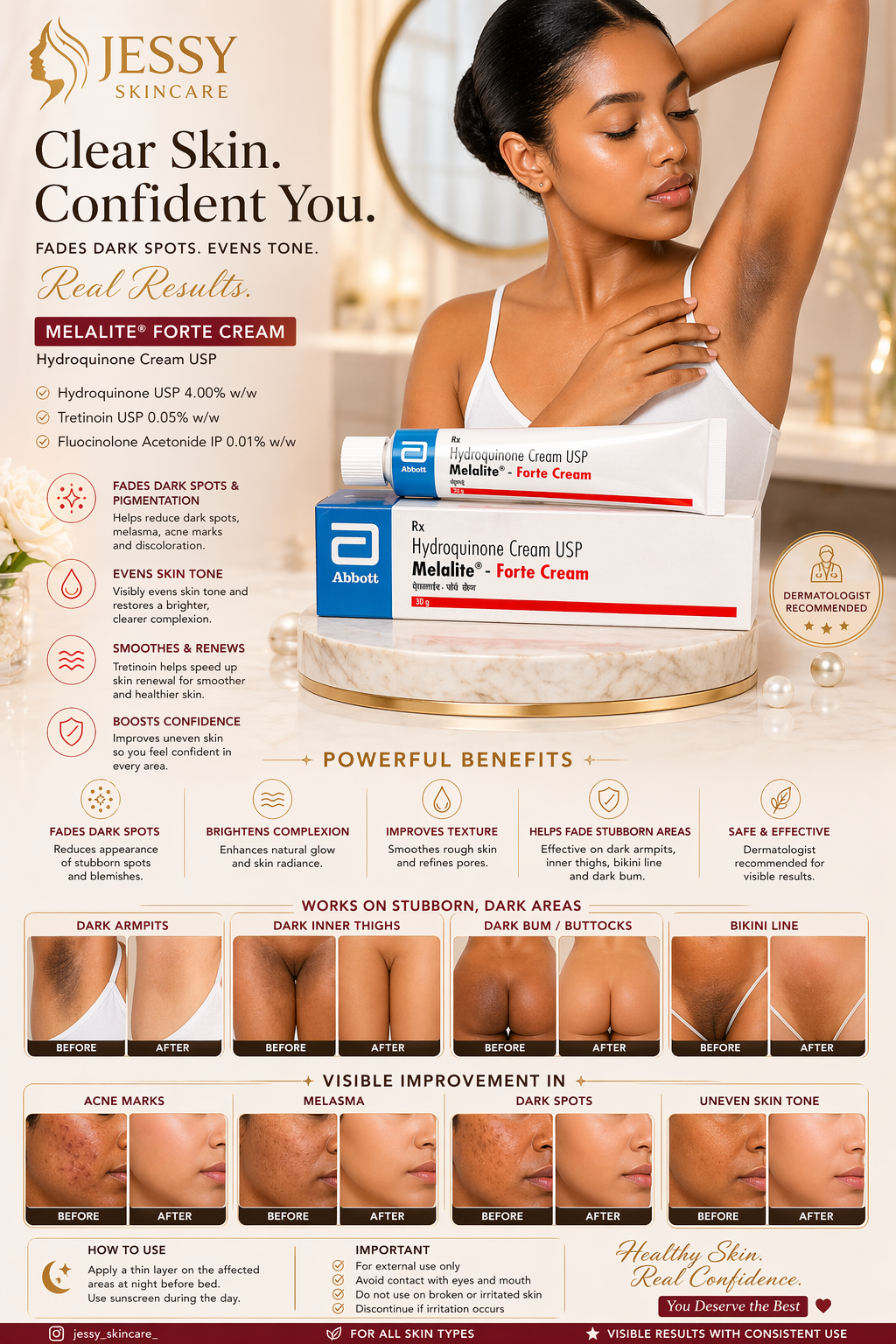 TUBO DI IDROCHINONE