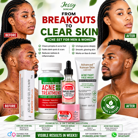 ACNE AND PIMPLES SET