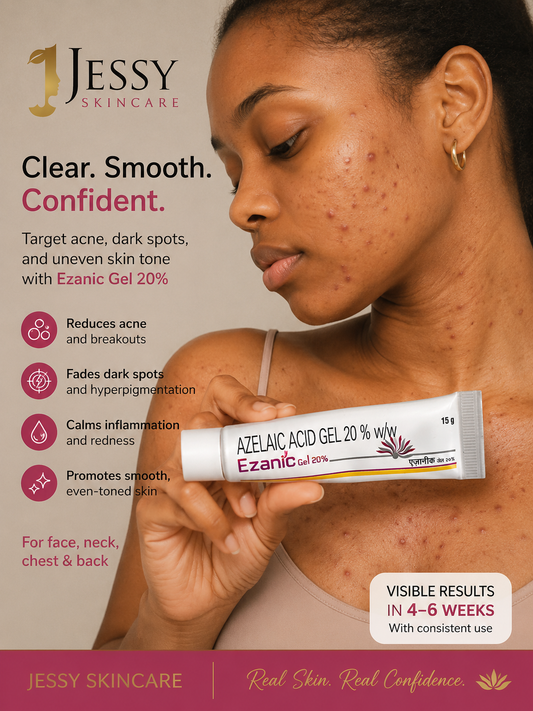 AZELAIC ACID FOR ACNE