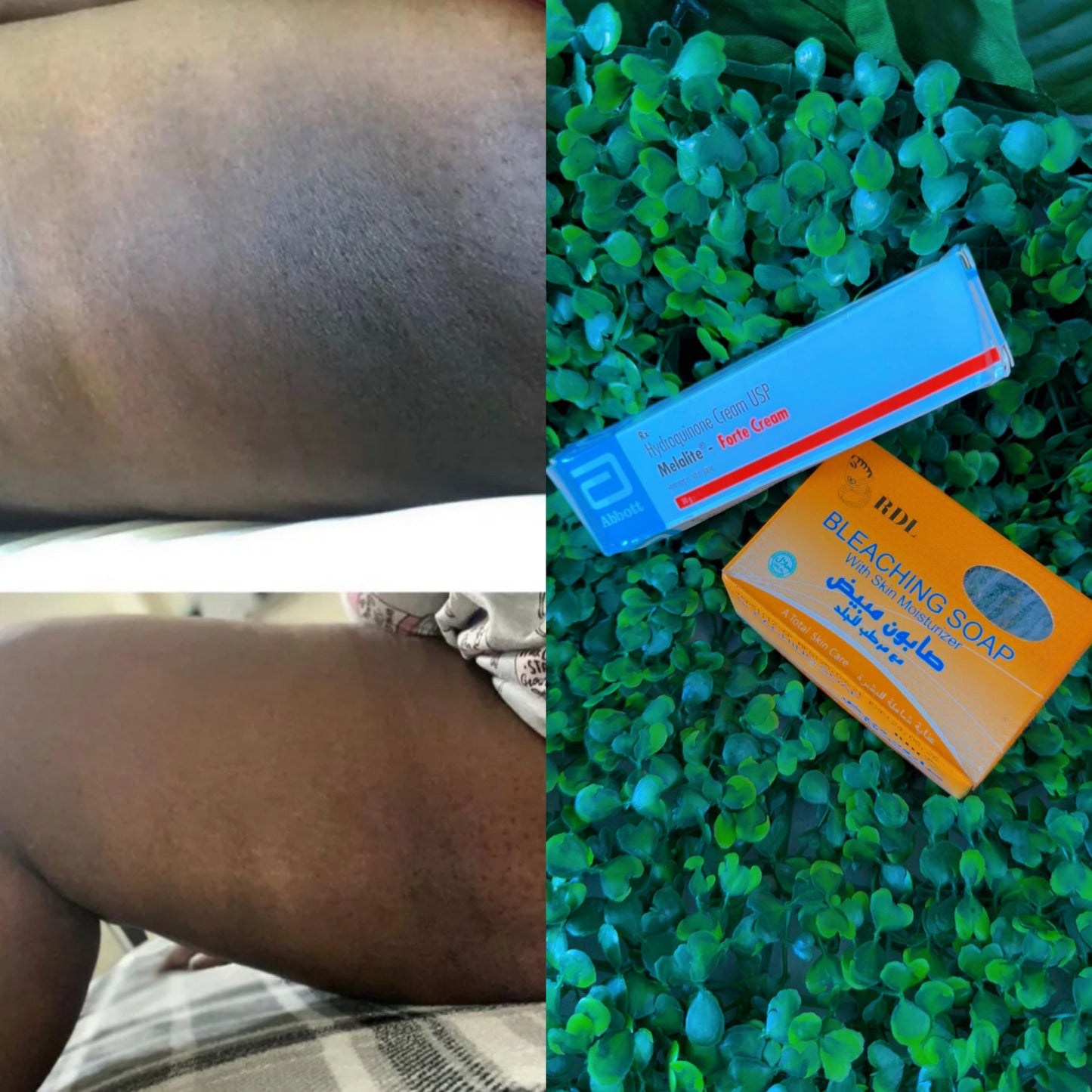 DARK INNER COMBO SET